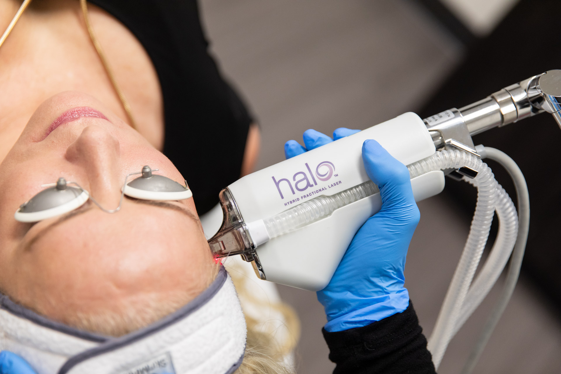 Halo procedure with a top down view